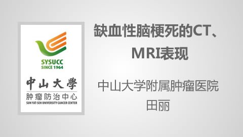 缺血性脑梗死的CT、MRI表现