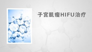 子宫肌瘤HIFU治疗