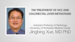 Y90 TREATMENT OF HCC AND COLORECTAL LIVER METASTASIS 