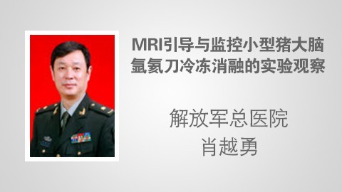 MRI引导下小型猪大脑氩氦刀冷冻消融的实验观察 