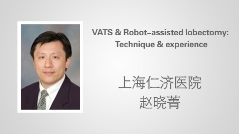 VATS & Robot-assisted lobectomy Technique & experience 