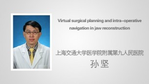 Virtual surgical planning and intra-operative navigation in jaw reconstruction