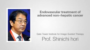 Endovascular treatment of advanced non-hepatic cancer