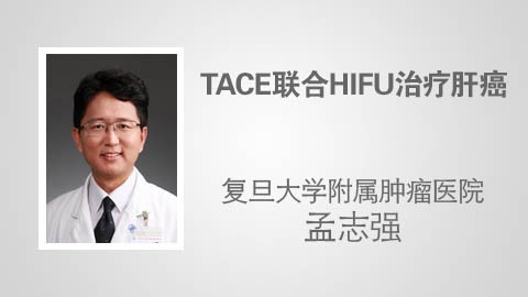 TACE联合HIFU治疗肝癌