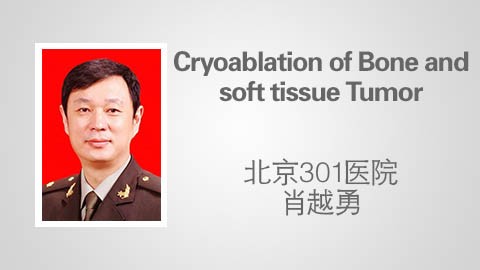 Cryoablation of Bone and soft tissue Tumor